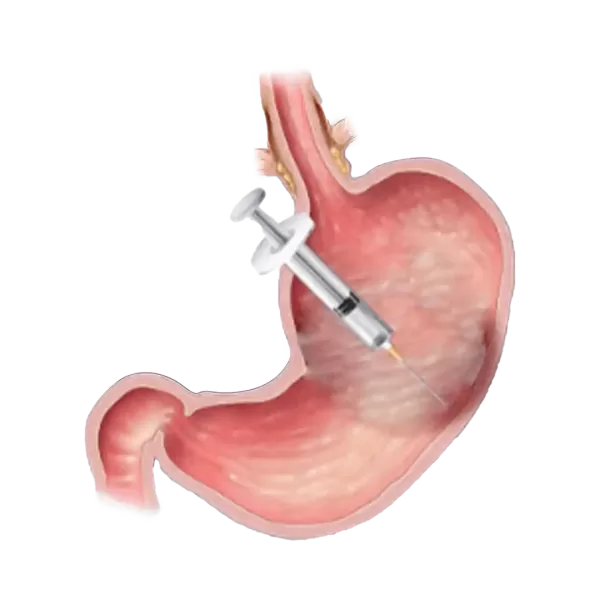 Bariatric Surgery