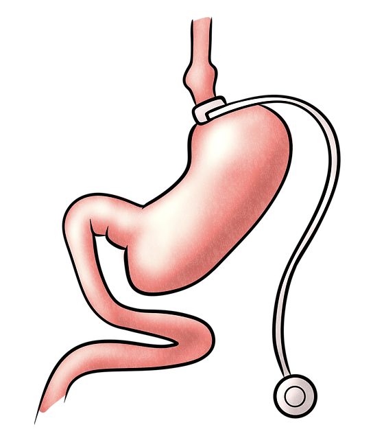 Bariatric Surgery