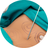 Classic liposuction fotor 20230718182336 1