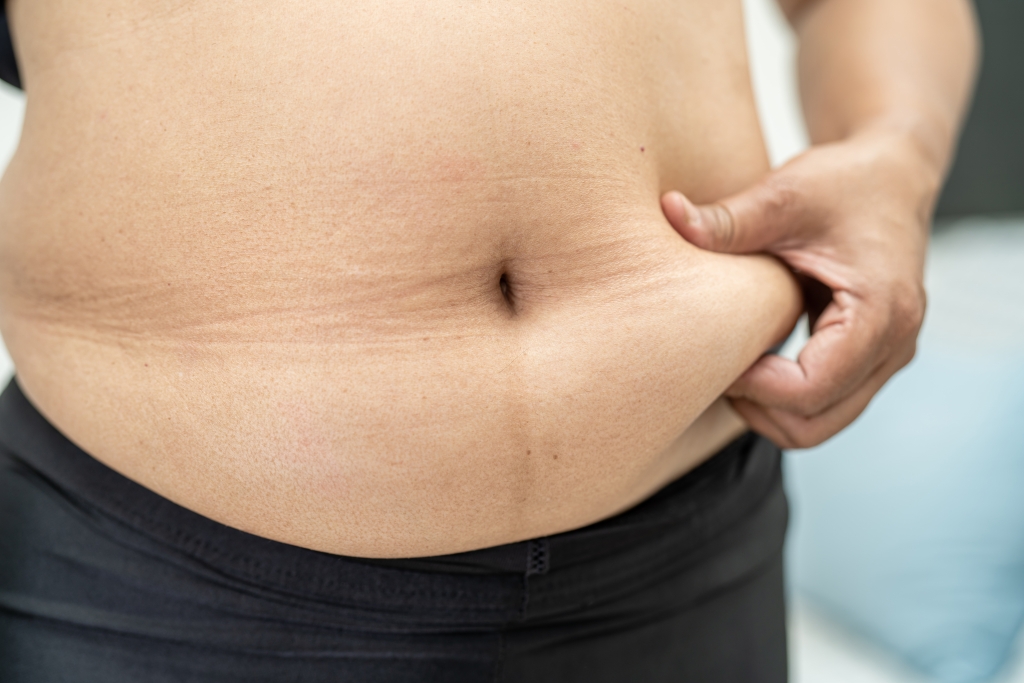 overweight asian woman show fat belly at office 2022 10 05 20 15 46 utc scaled Bariatric Surgery