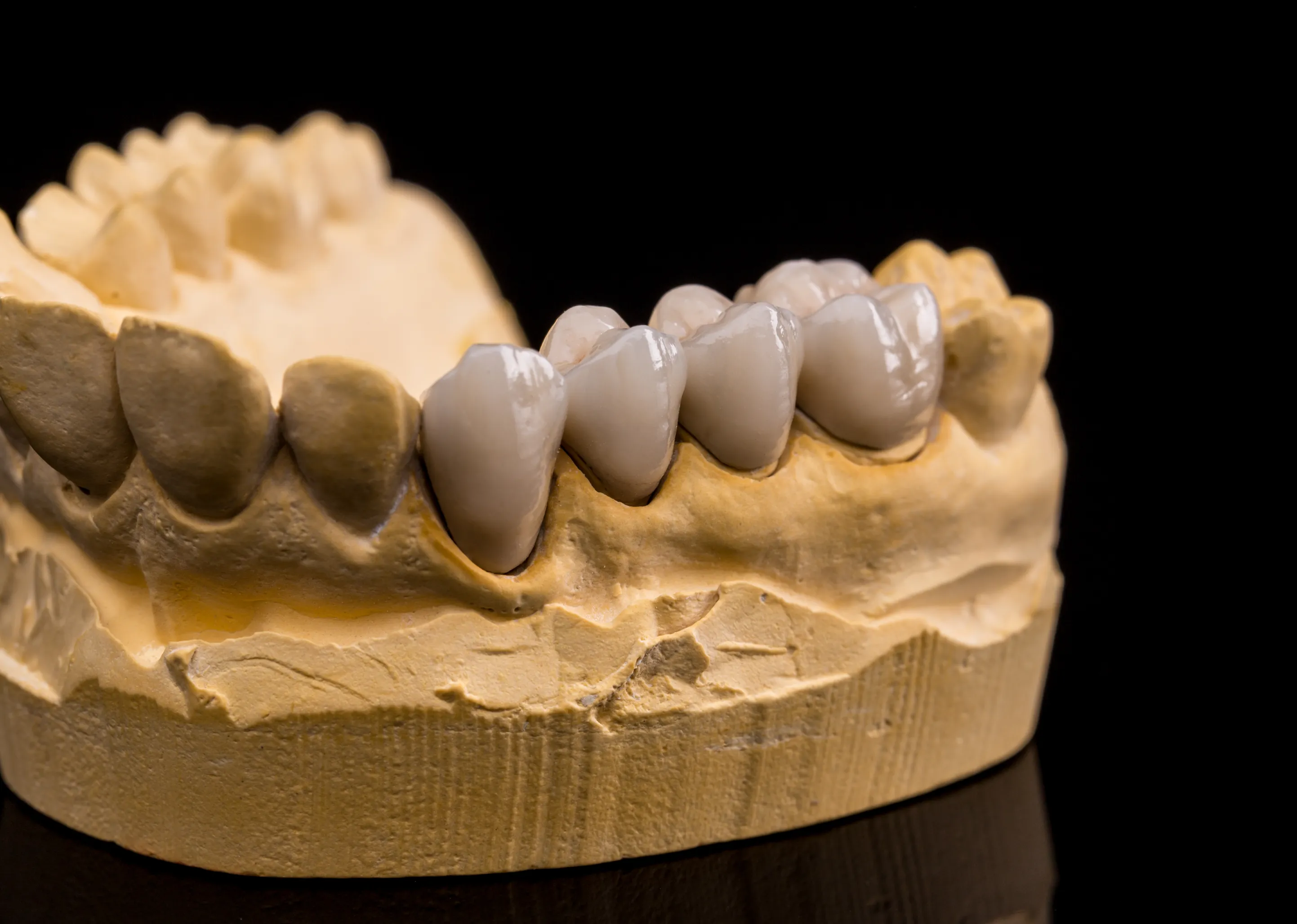 Dentures