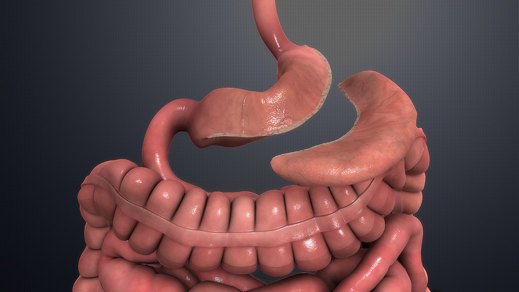 Gastric sleeve surgery 1