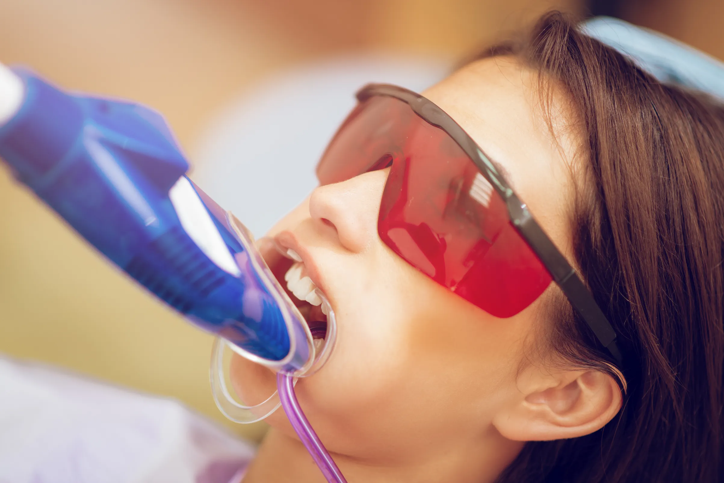 laser teeth whitening
