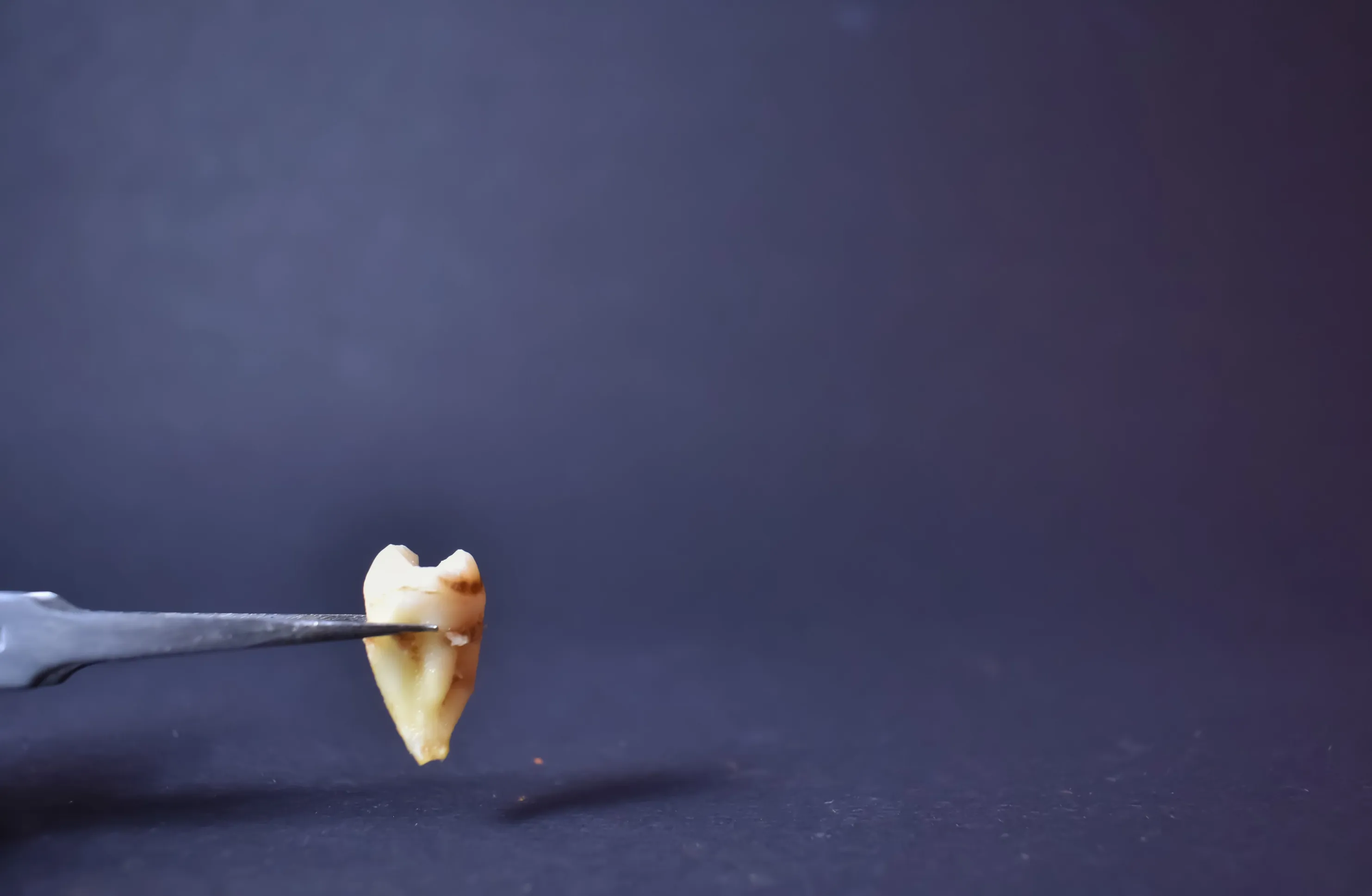 molar teeth
