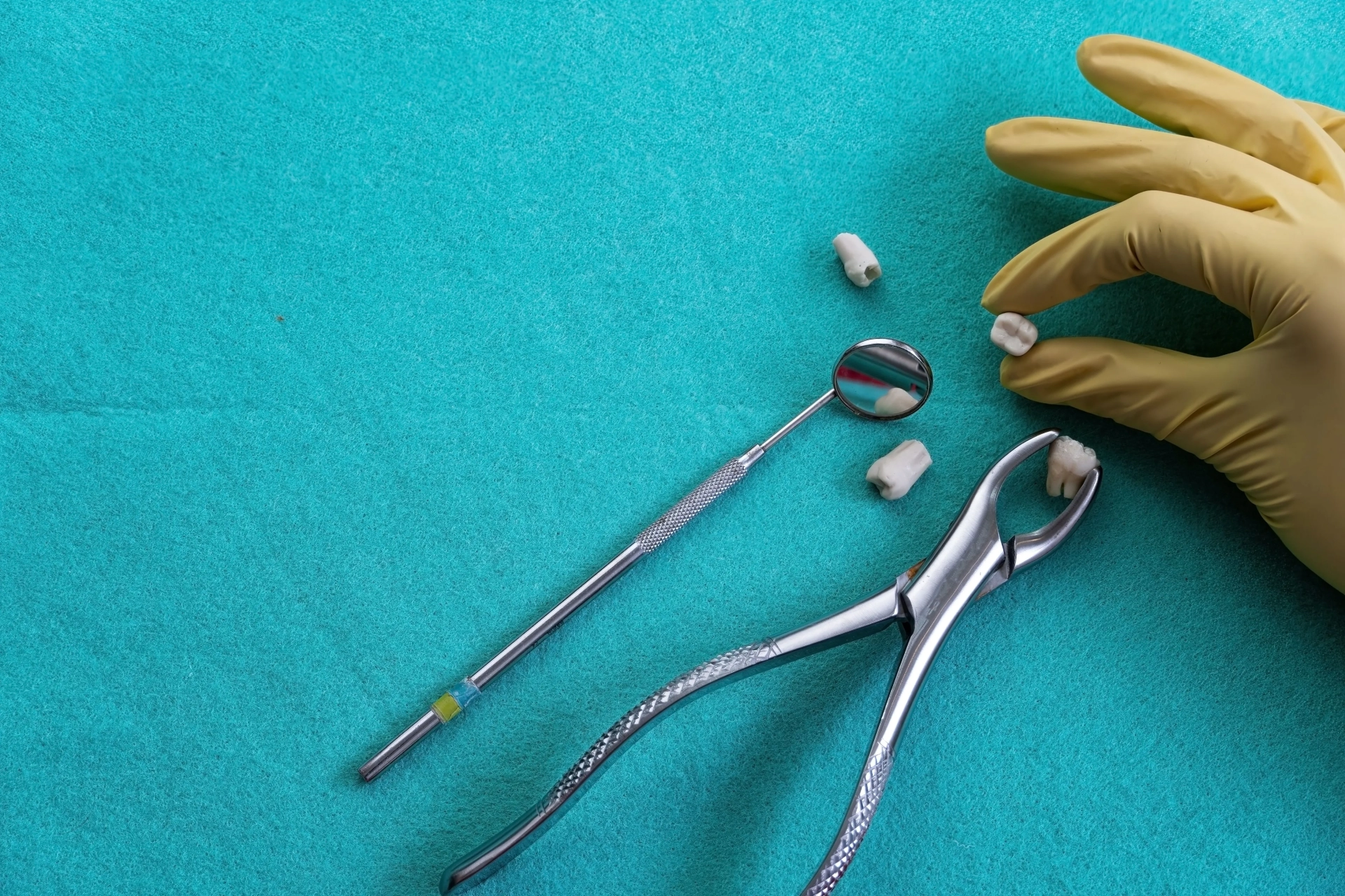 tooth extraction 2