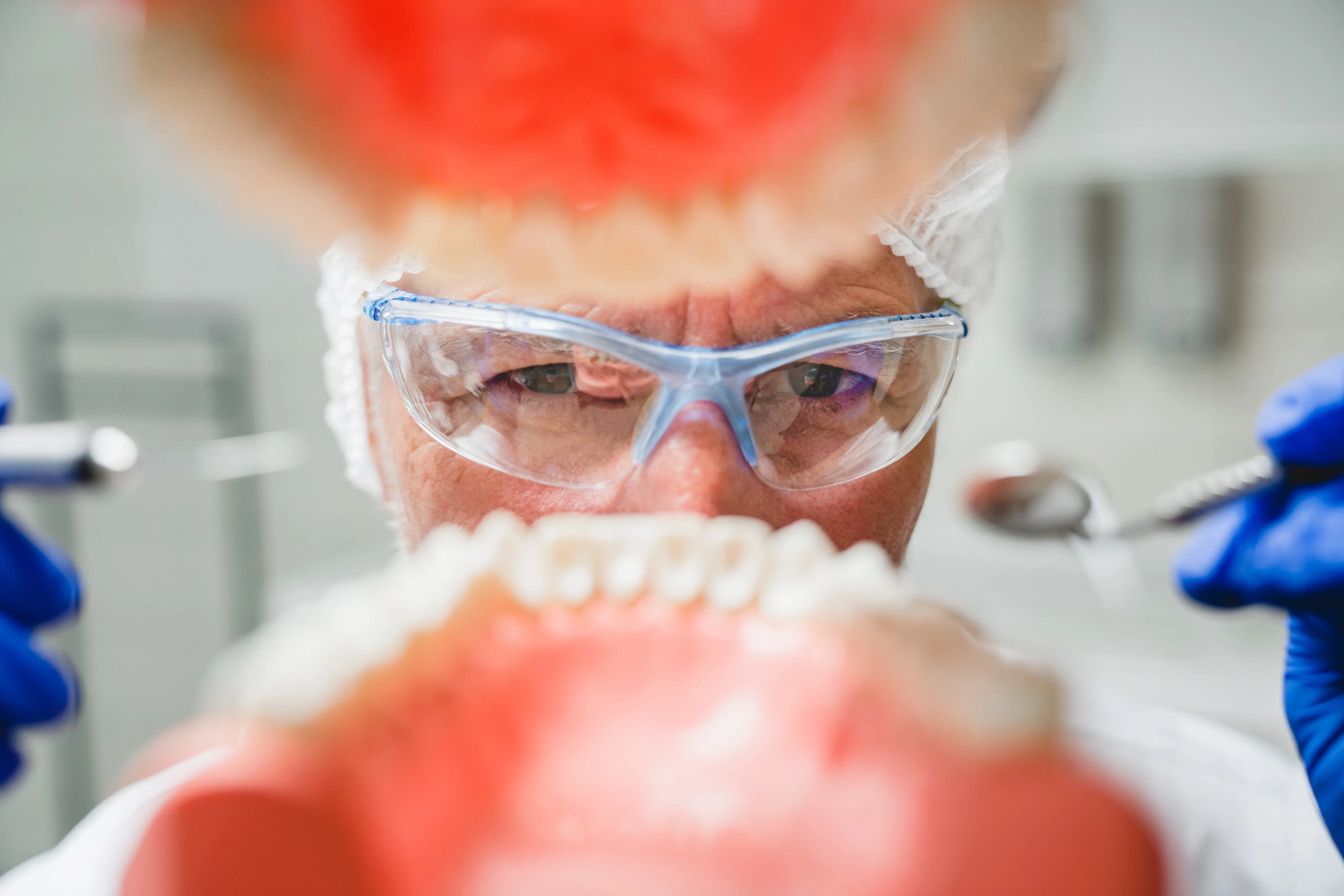 tooth filling