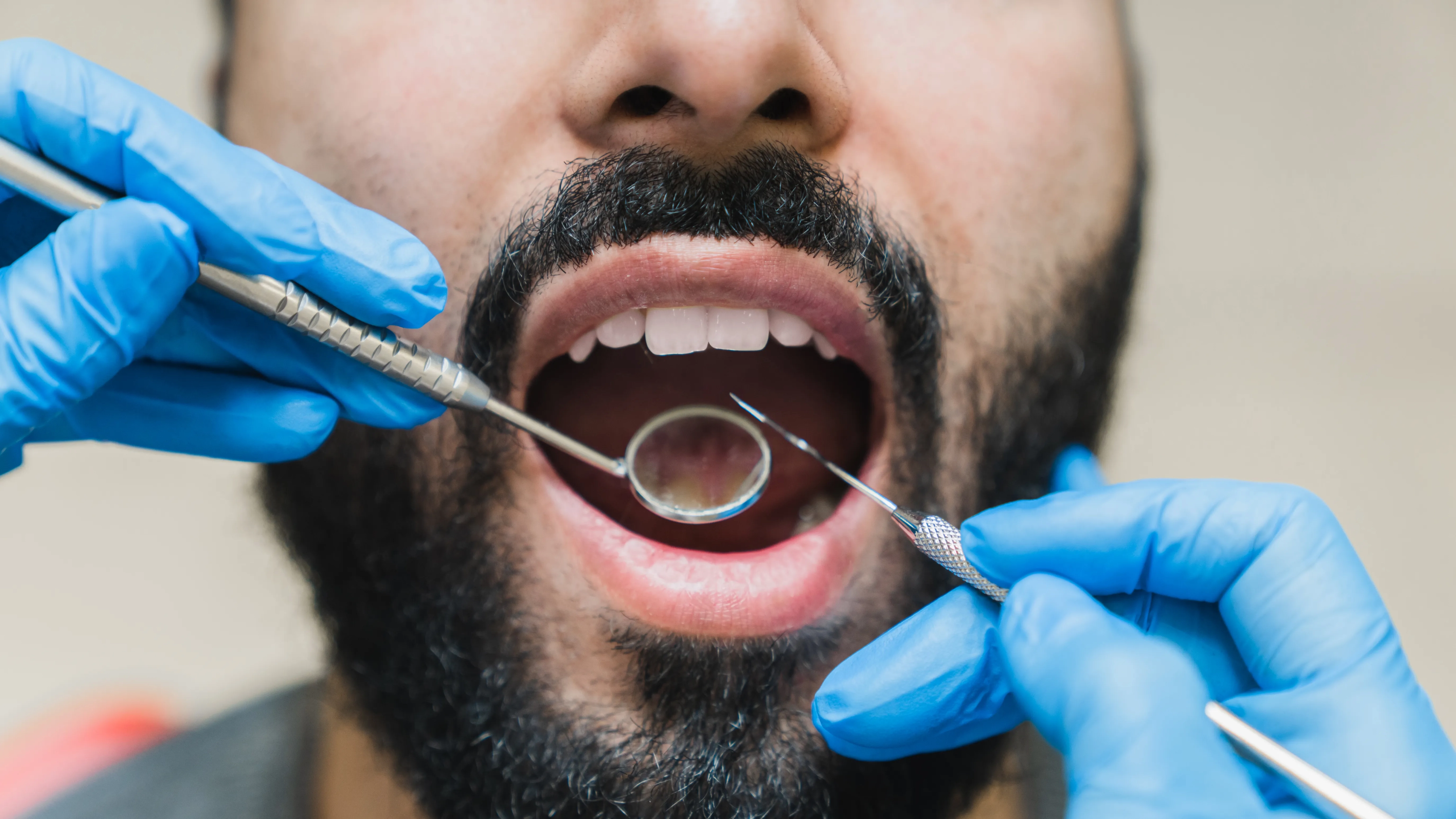 veneer teeth scaled