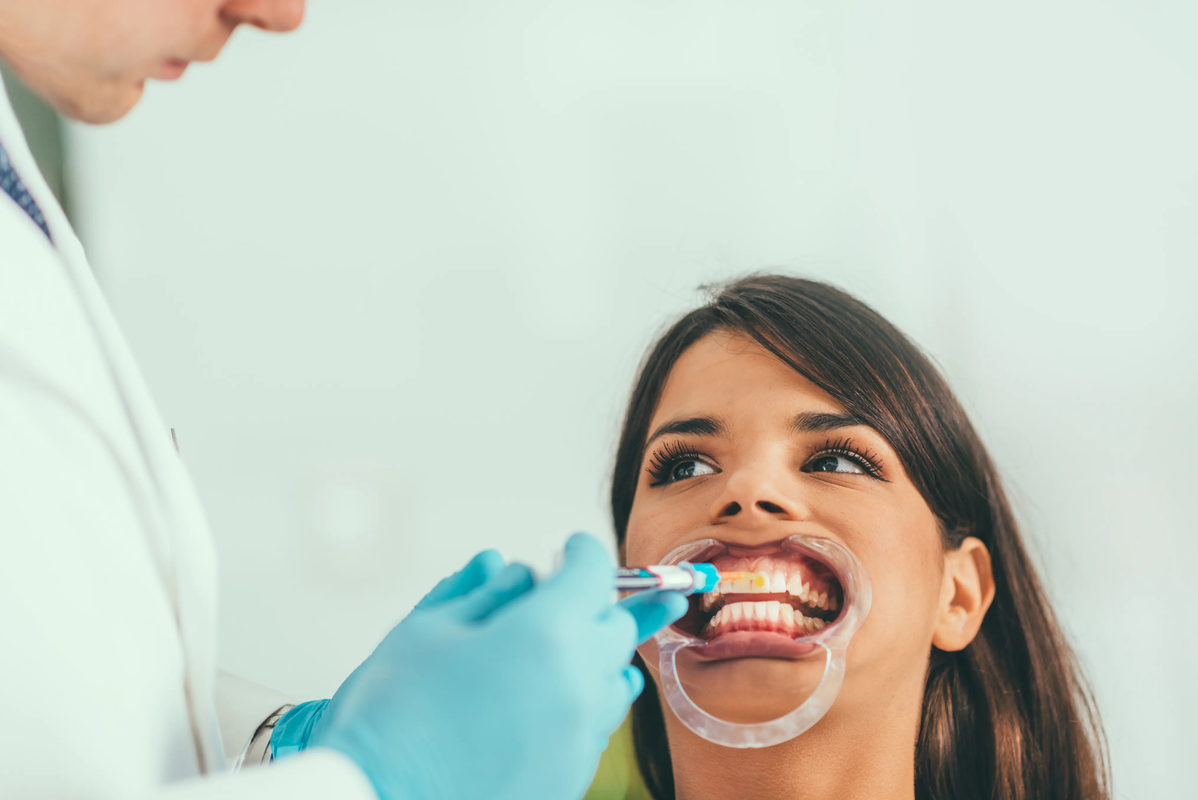 whitener for teeth